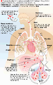 The effects of Asbestos on the human body.